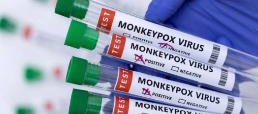 Ministério da Saúde discute plano de contingência contra mpox